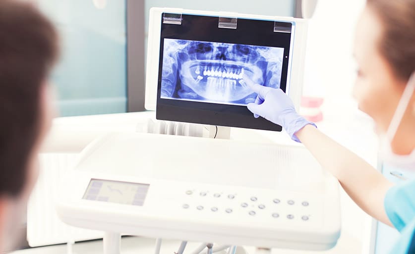 Digital dental x rays
